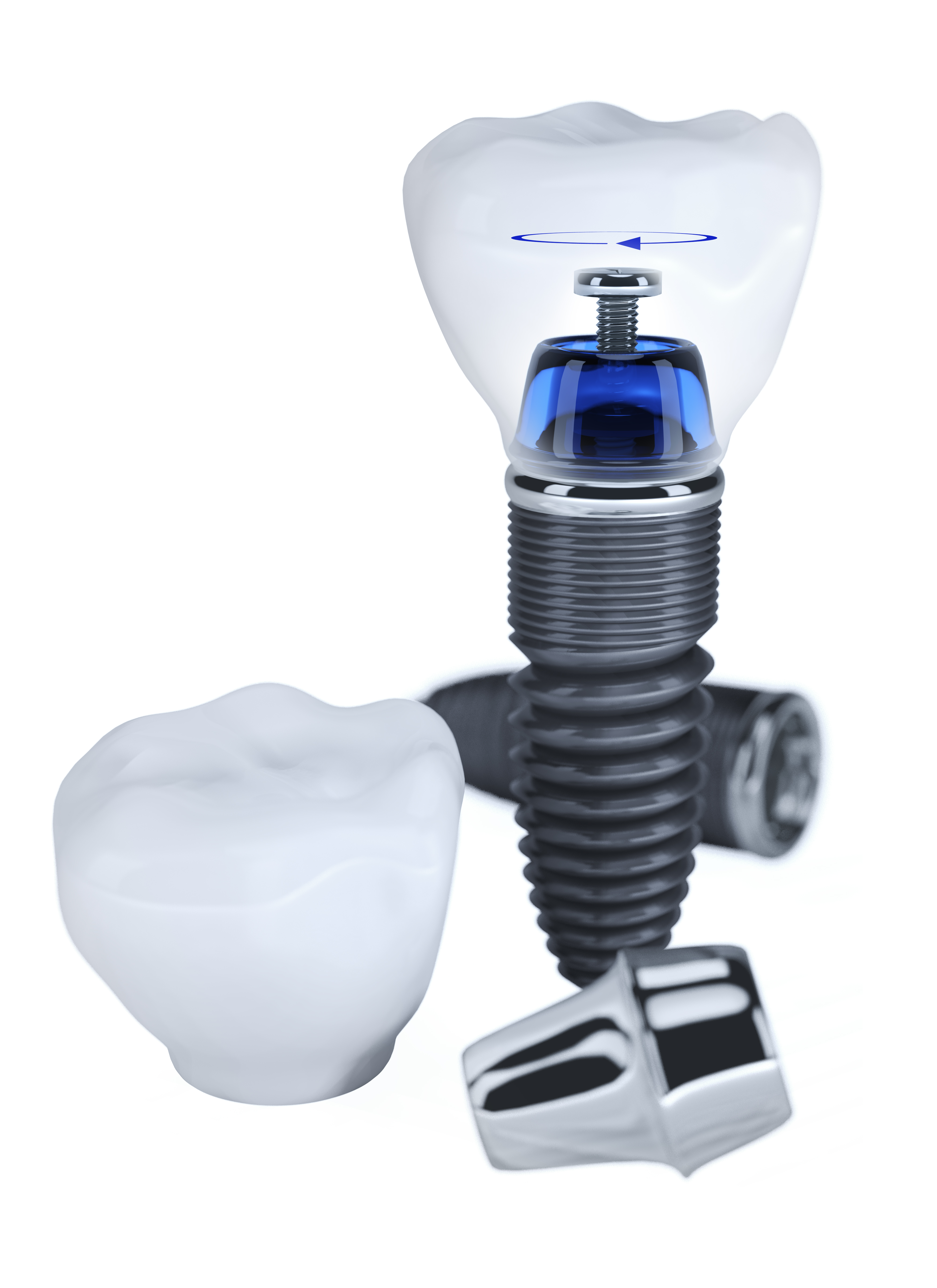 Dental Implants - Kyle, TX - Restore Your Smile