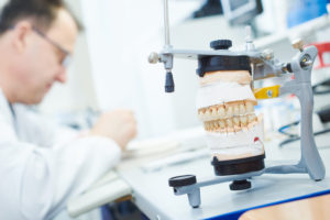 Prosthodontist designing dental implant prosthesis
