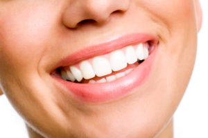dental implants and smile